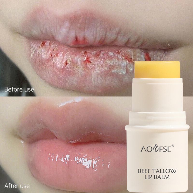 best lip balm for cracked dry lips